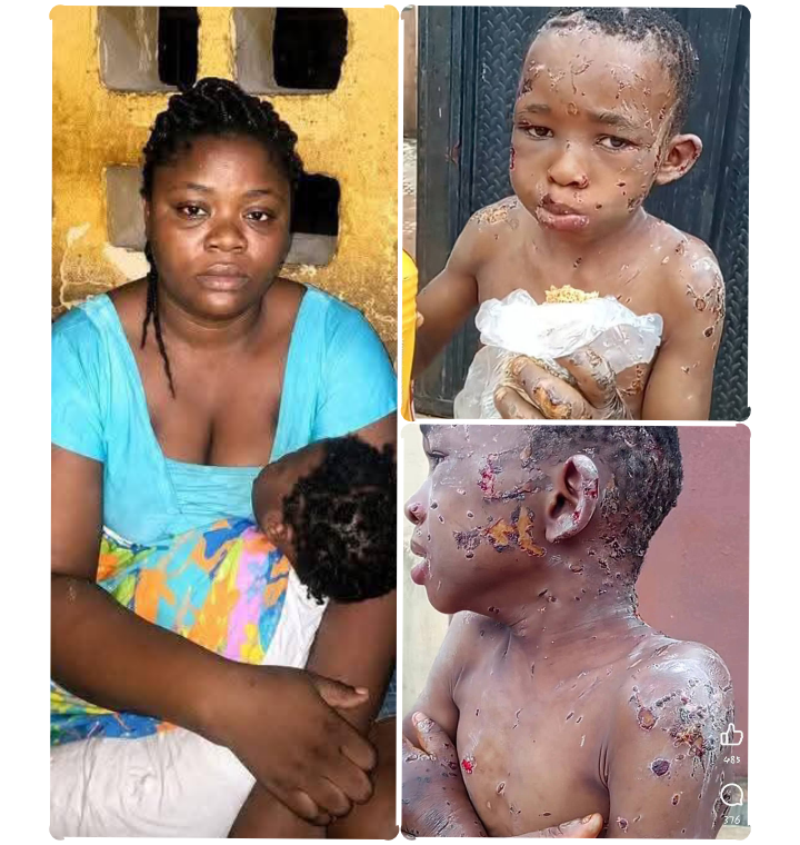 Anambra First Lady takes over care of abused 10-year-old boy, demands justice